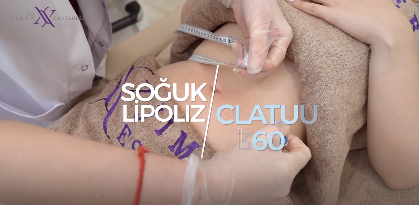 Cryolipolysis Clatuu 360 - Freeze and Eliminate Regional Fat! - Slimming in one session!